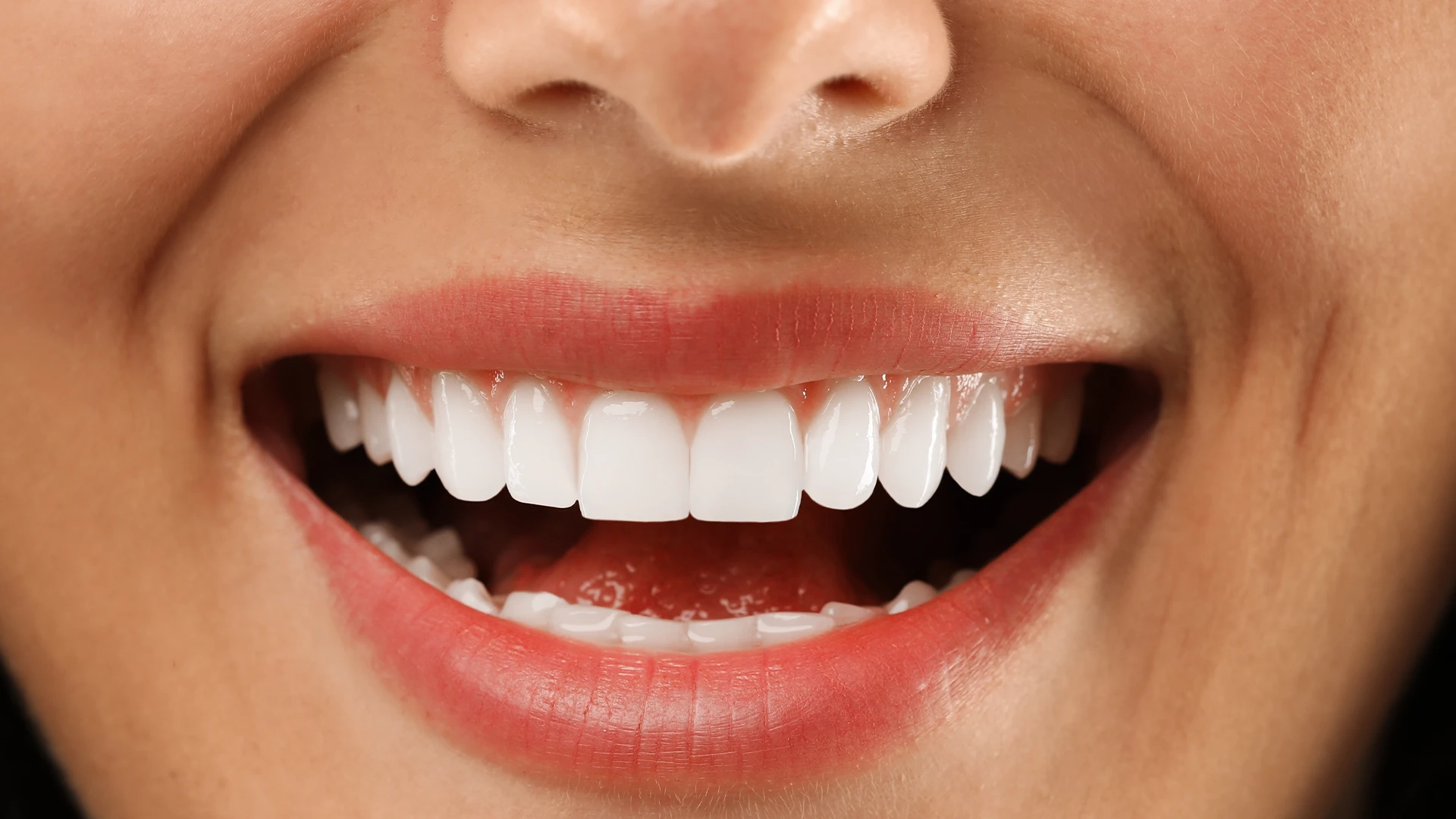 What Are All-on-4 and All-on-6 Implants? Key Differences Explained
