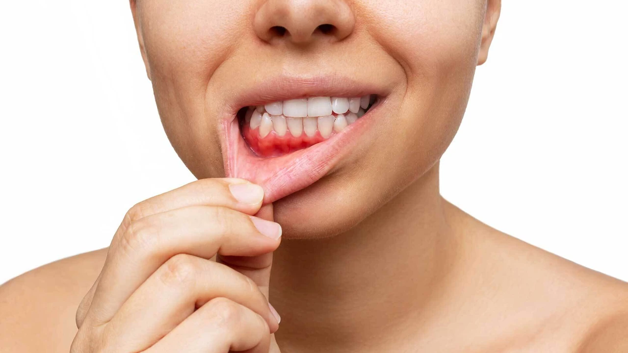 Diş Eti Çekilmesine Ne İyi Gelir? Evde Alınabilecek Önlemler ve Klinik Tedavi Yöntemleri