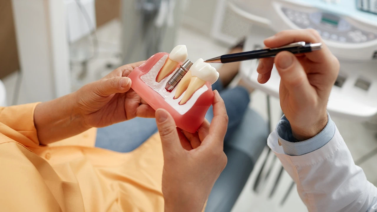 What Are All-on-4 Dental Implants? Cost & Benefits Explained