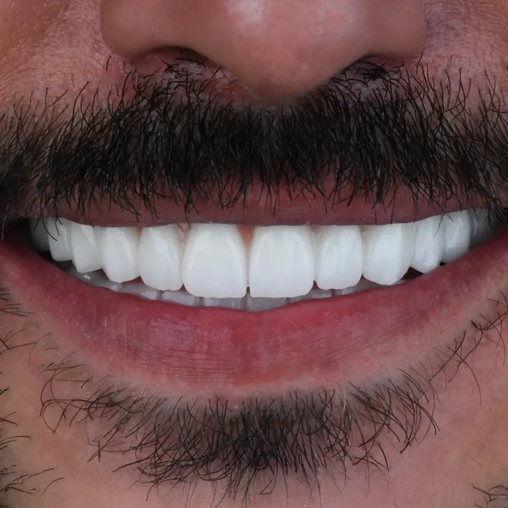 Cosmetic Dentistry Cosmetic Dentistry