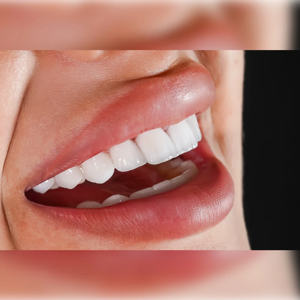 Dental Bridge Dental Bridge