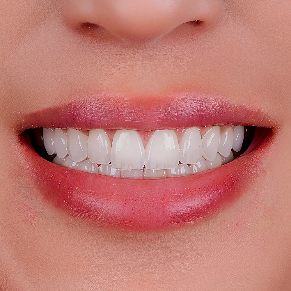 Dental Crowns Dental Crowns
