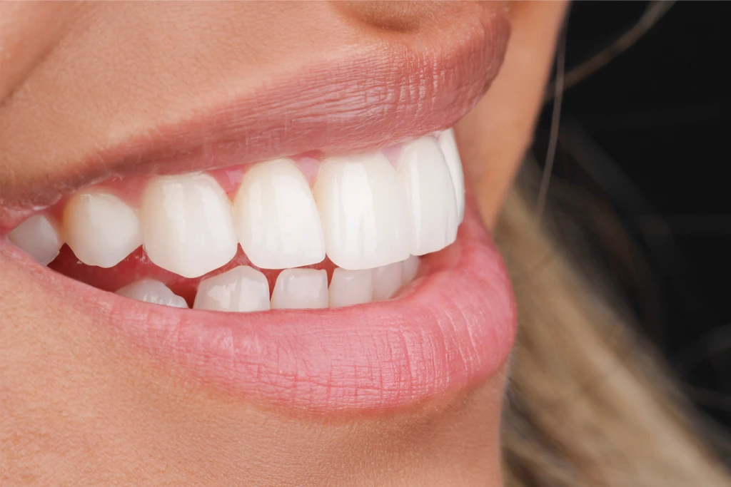 Dentures Dentures