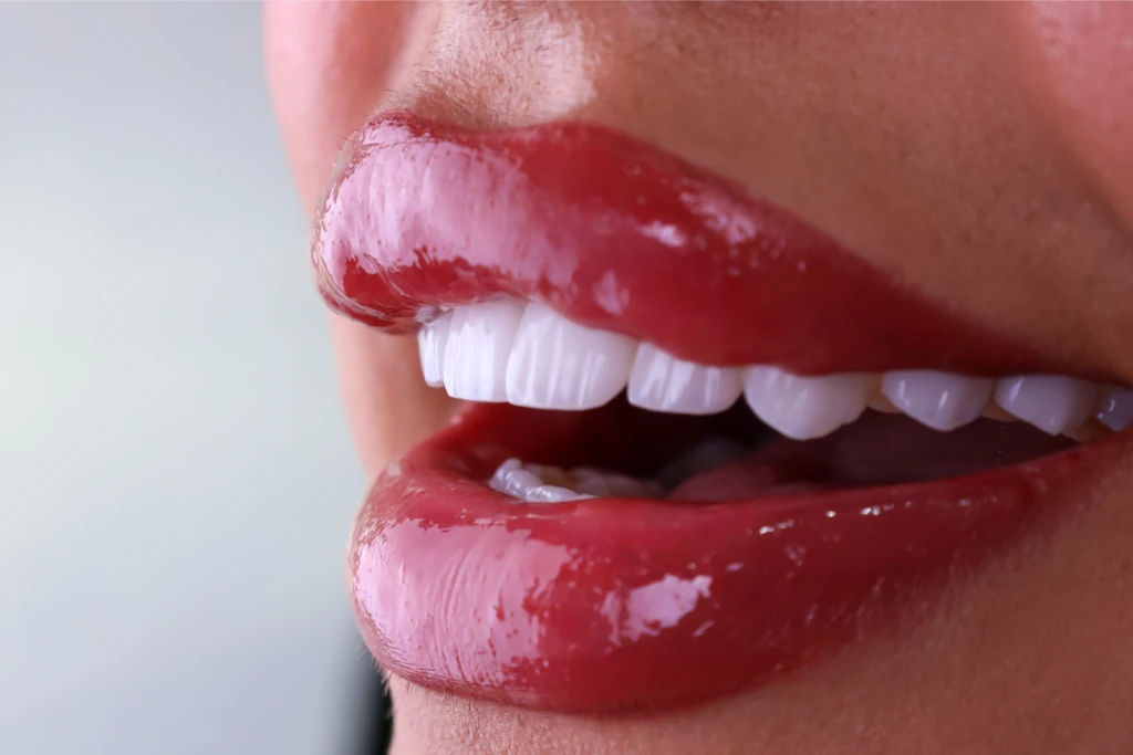 Same Day (Immediate) Dental Implants Same Day (Immediate) Dental Implants