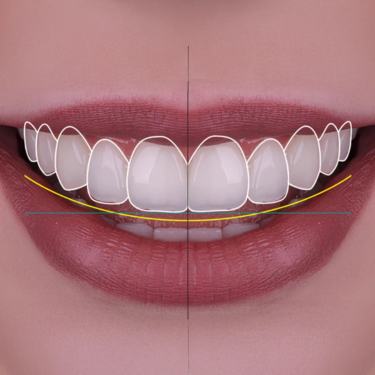 The Mediterranean Dental Art Experience with UltraDent Turkey The Mediterranean Dental Art Experience with UltraDent Turkey
