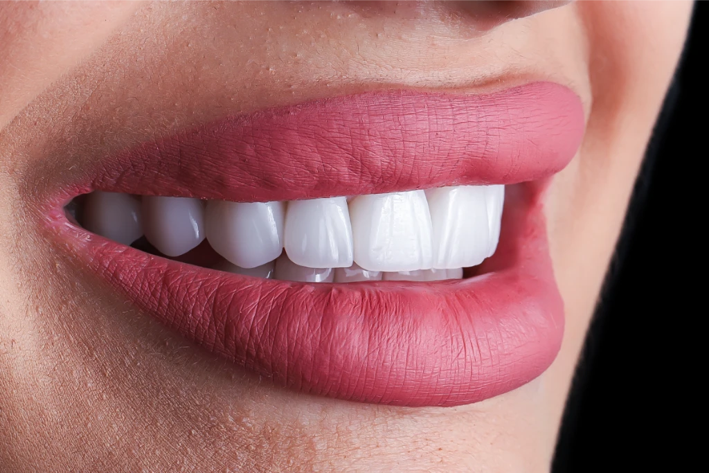 Metal Porcelain Crowns Antalya Metal Porcelain Crowns Antalya