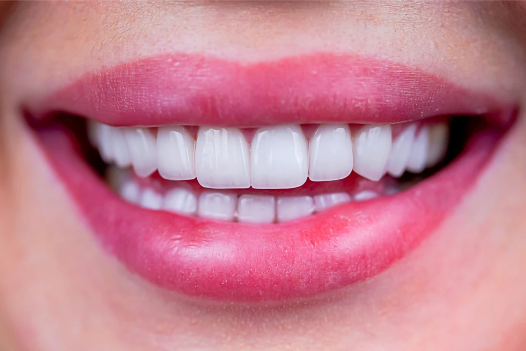 Root Canal Treatment Root Canal Treatment