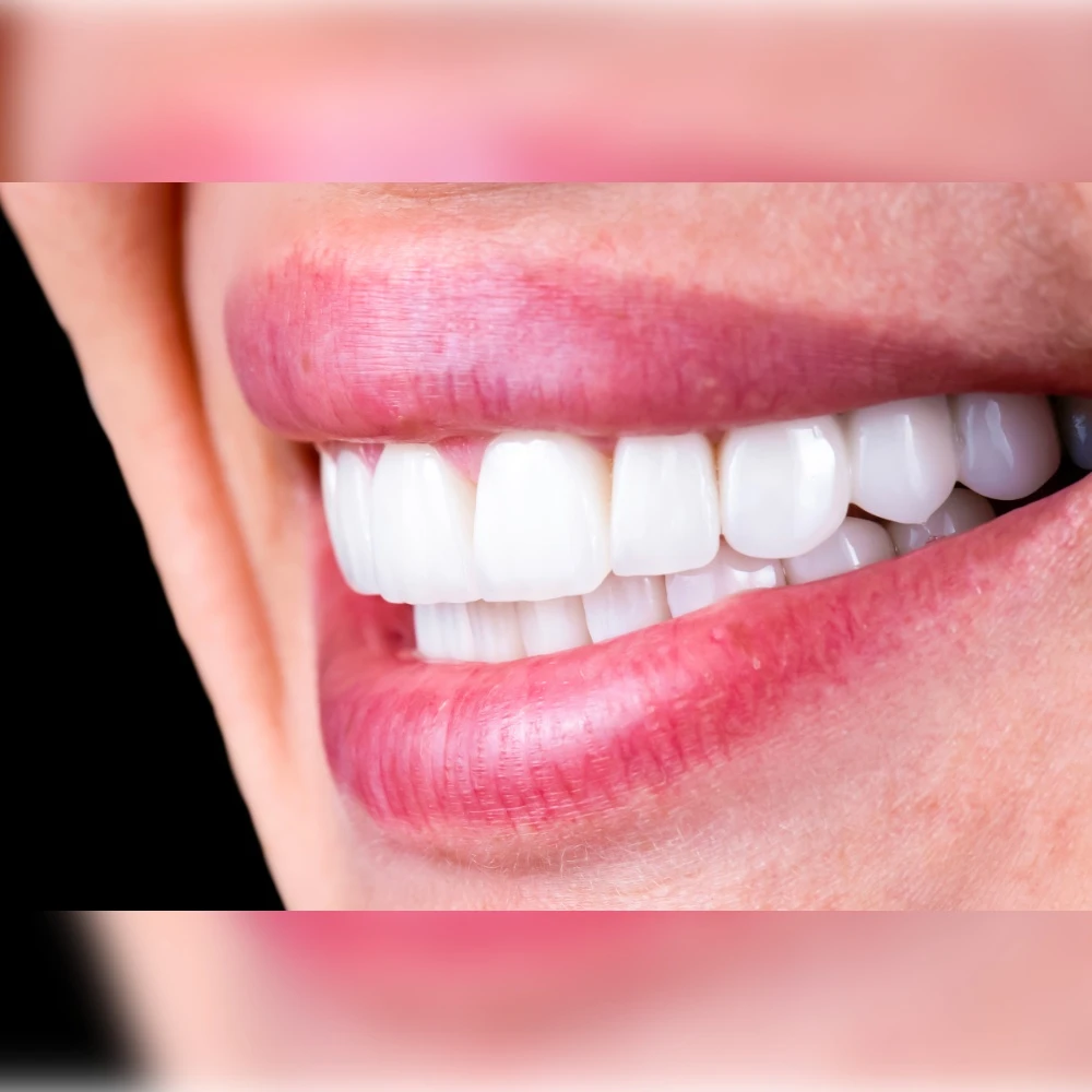 -Tooth Extraction Tooth Extraction