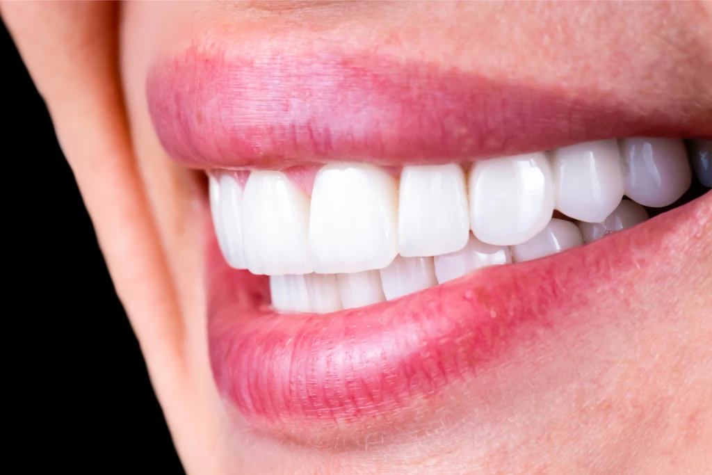 Tooth Extraction Tooth Extraction