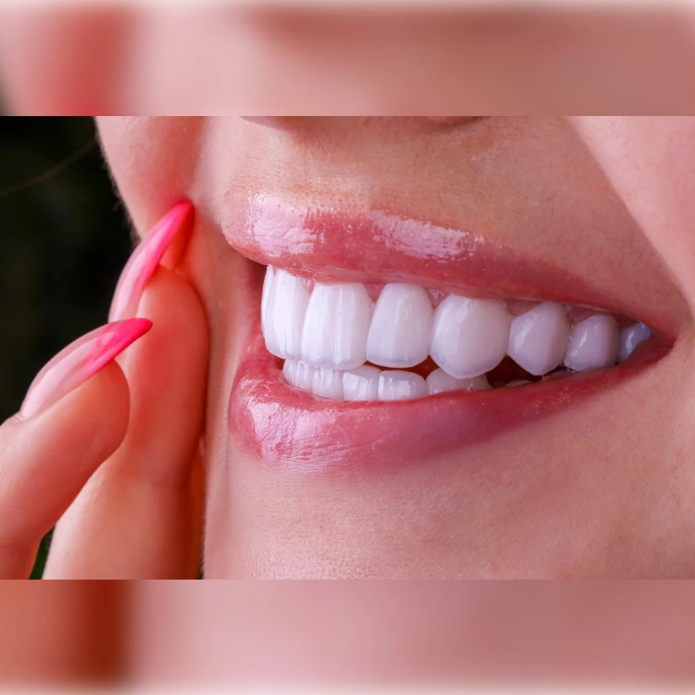 Wisdom Tooth Extraction Wisdom Tooth Extraction