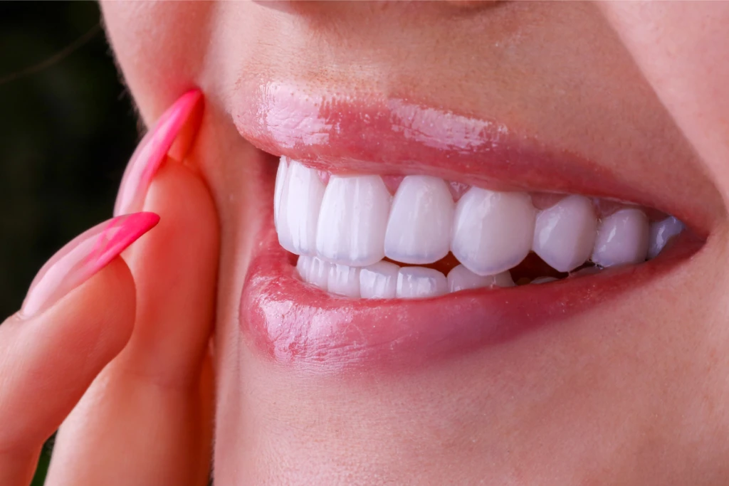 Wisdom Tooth Extraction Wisdom Tooth Extraction
