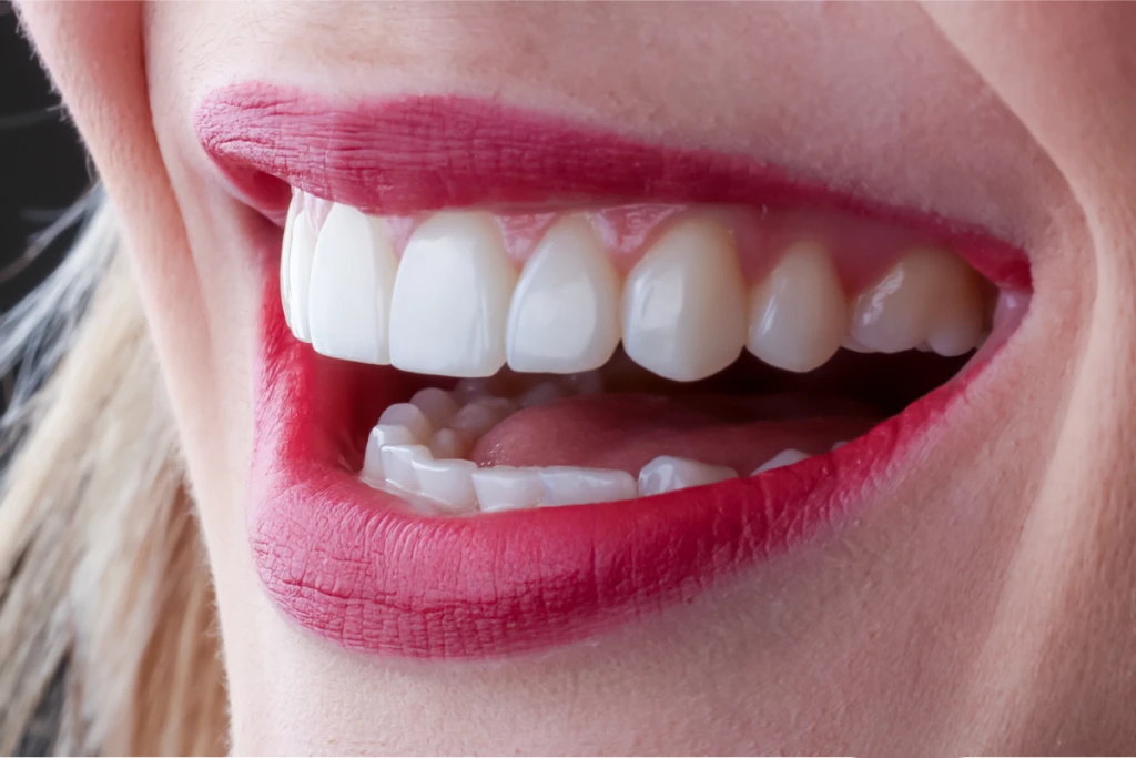 Zirconium Implant Treatment Zirconium Implant Treatment